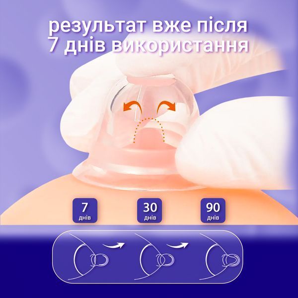 Силіконові накладки LELIK&trade; Breast Care для комфорту під час грудного вигодовування, з кейсом 4014409 фото